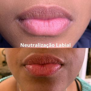 Neutralização Labial